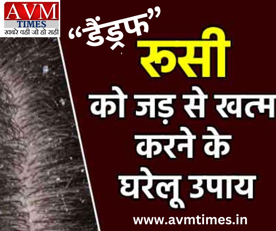 “डैंड्रफ” रूसी को जड़ से ख़त्म करने के उपाय