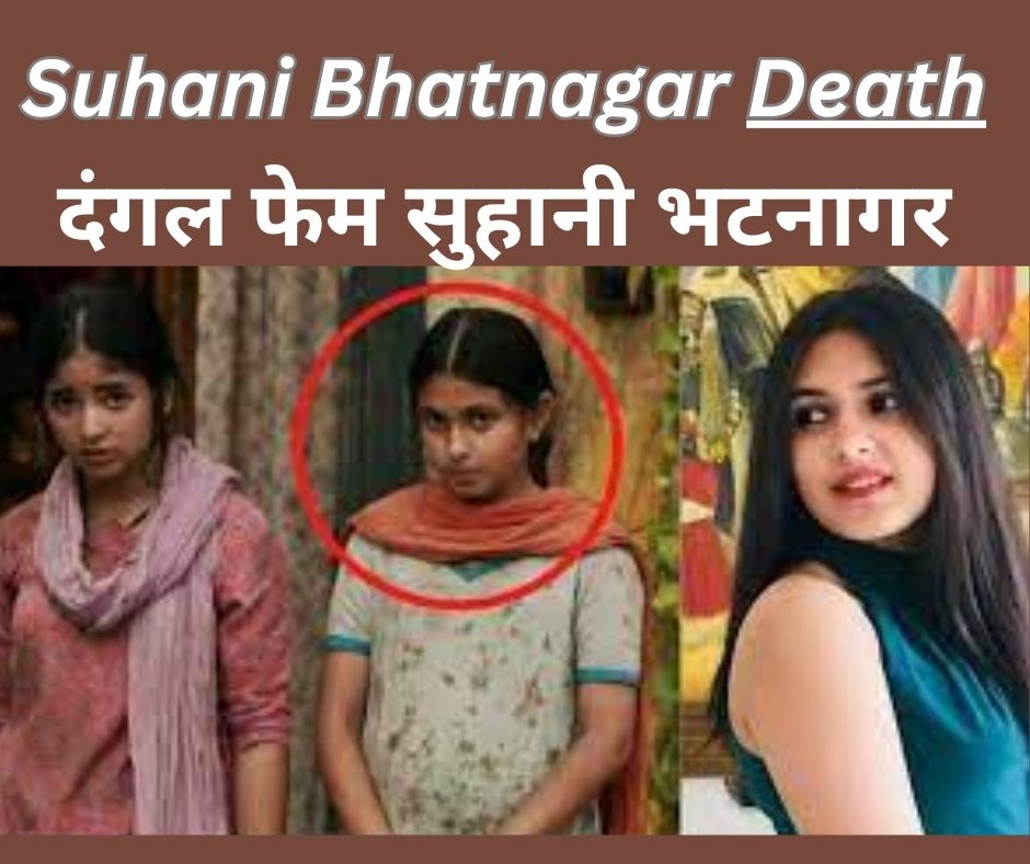 Suhani Bhatnagar Death: दंगल फेम सुहानी भटनागर का हुआ निधन, जानिए मौत का कारण!